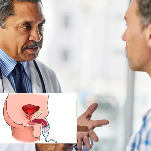 Understanding the Types of Penile Implants Available