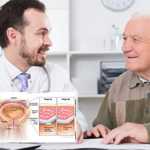 Restoring Confidence with Cutting-Edge Penile Implants
